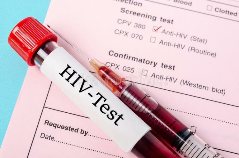 සැලෝන්වලදිත් HIV බෝවෙන්න පුළුවන් සැලෝන්වලදිත් HIV බෝවෙන්න පුළුවන්